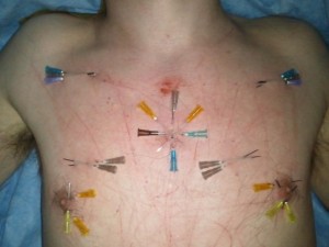 Needle Pattern