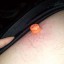 Side shot of nipple with elasticator bands