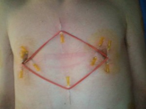 Nipple and chest piercing with rubber band