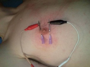 Closeup of electocuting nipple